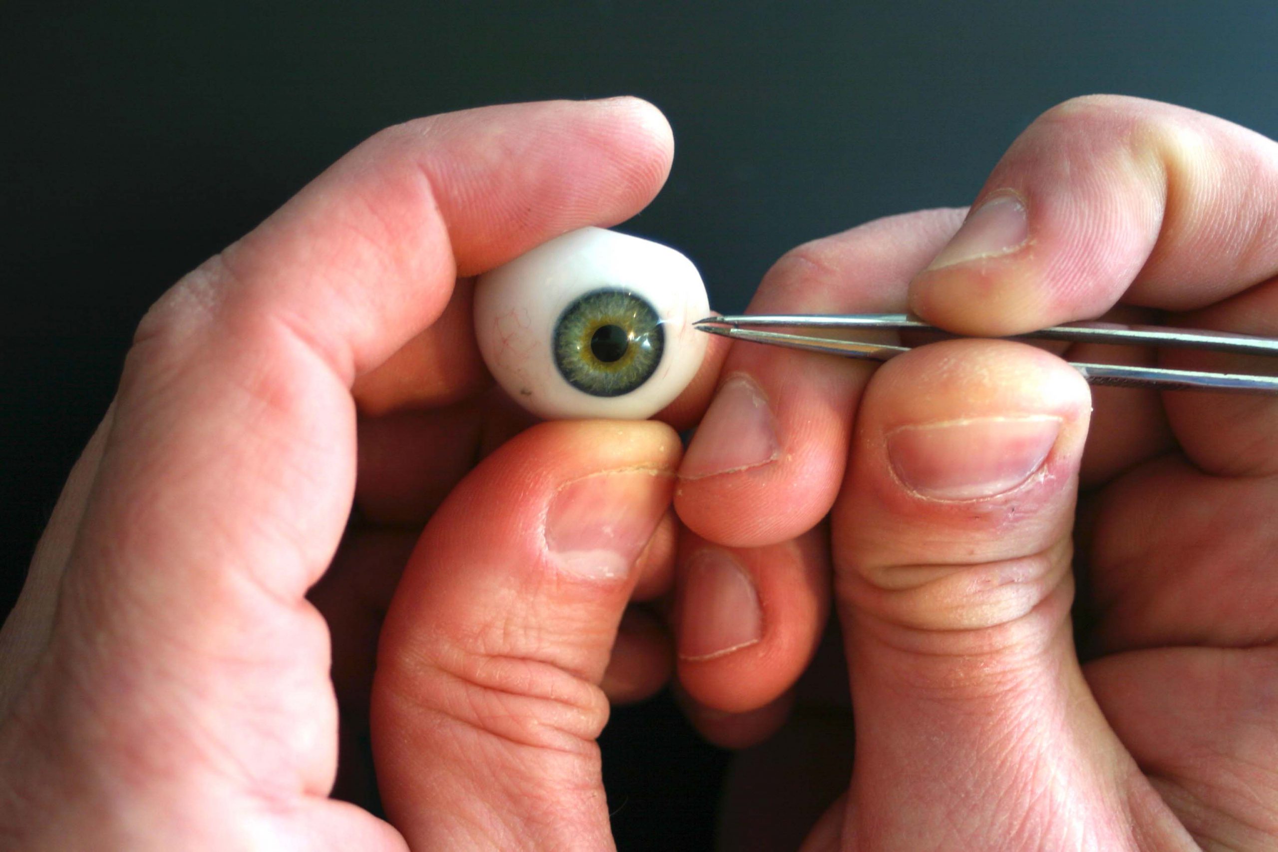 fabrication de prothèse oculaire