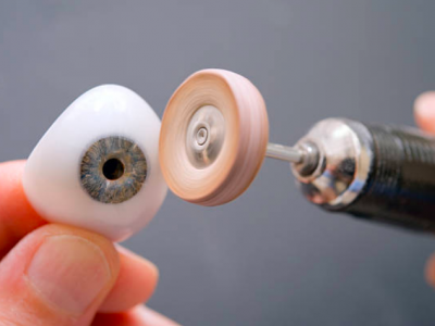 fabrication de prothèse oculaire ou oeil de verre